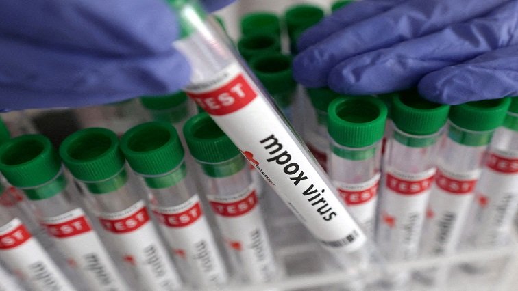 South Africans encouraged to be vigilant as new M-Pox variant spreads – SABC News