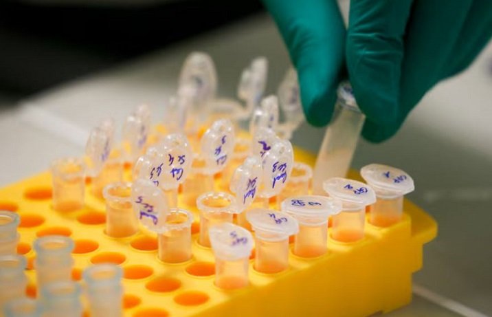 NGO raises concern over DNA testing backlog’s impact on GBV cases – SABC News