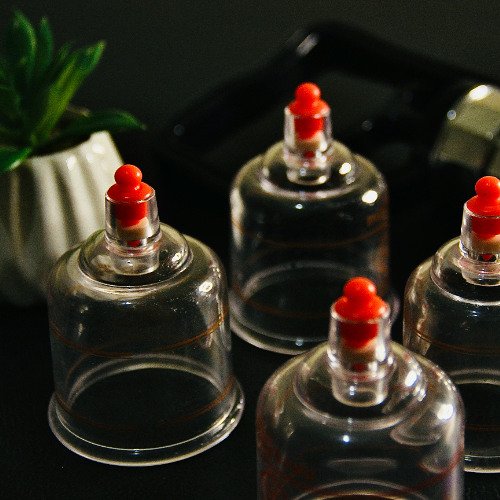 SA Hijama Society – Cupping for South Africa