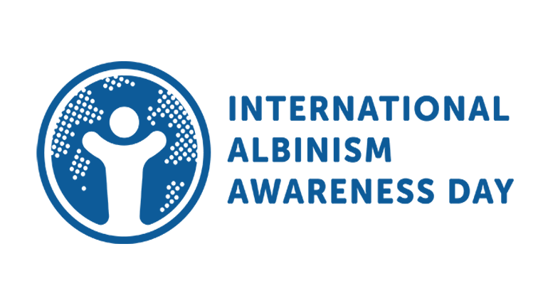 Gqeberha programme tackles Albinism health challenges – SABC News