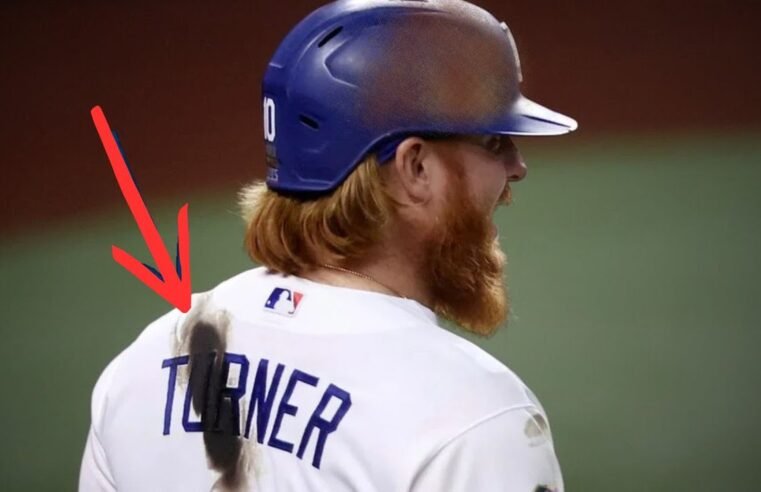 Why Baseball Players Put Sticky Stuff on Everything
