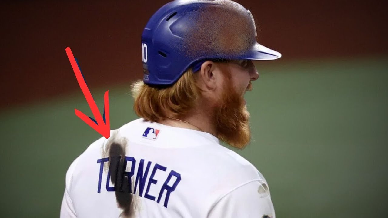 Why Baseball Players Put Sticky Stuff on Everything