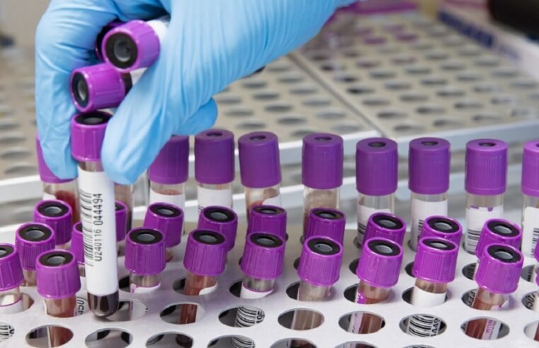KZN launches mass cervical cancer screening drive amid rising cases – SABC News