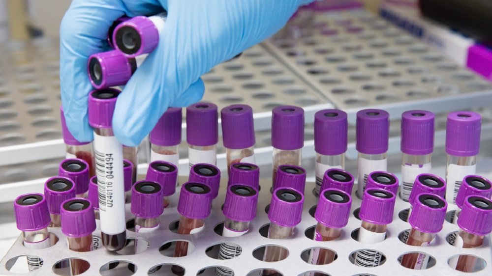 KZN launches mass cervical cancer screening drive amid rising cases – SABC News