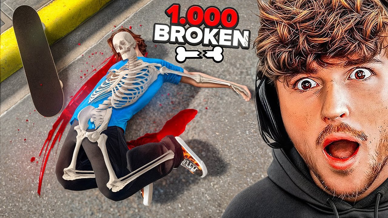 Breaking All 1000 BONES As a Professional Skateboarder!